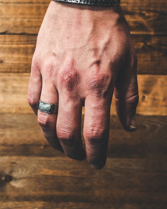Alvan Ring